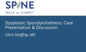 Dysplastic Spondylolisthesis: Case Presentation & Discussion