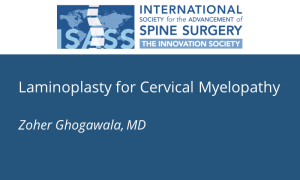 Laminoplasty for Cervical Myelopathy