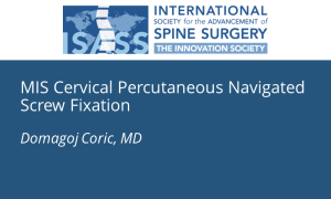 MIS Cervical Percutaneous Navigated Screw Fixation