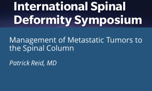 Management of Metastatic Tumors to the Spinal Column