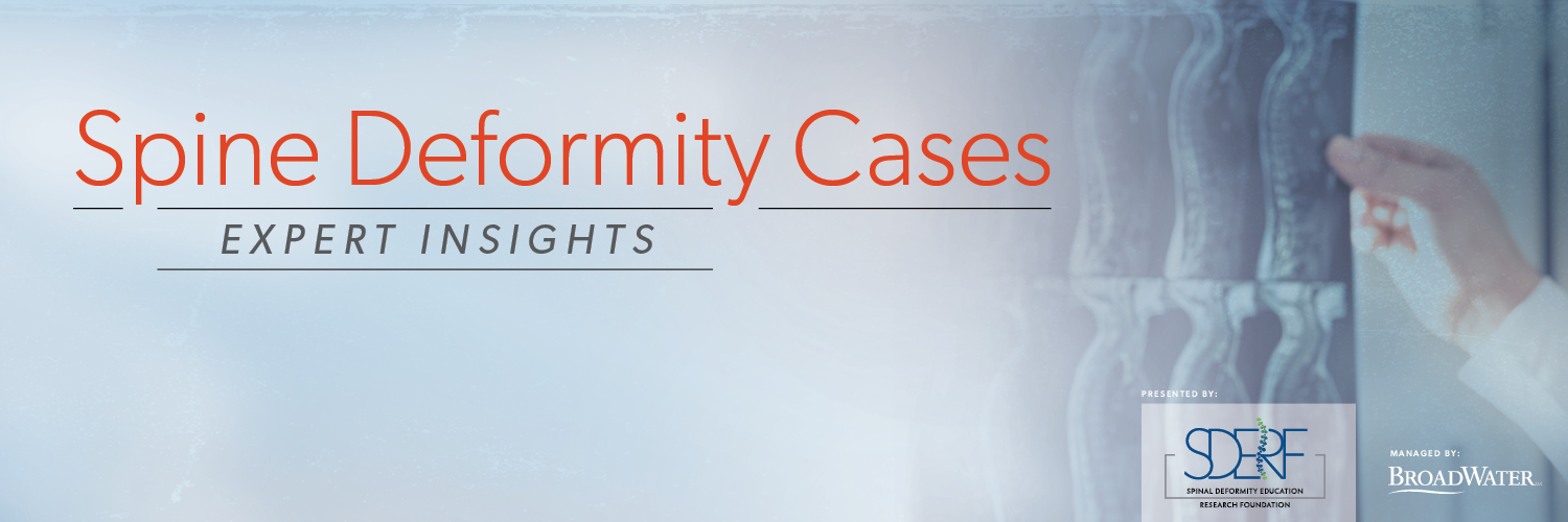 Spine Deformity Cases Webinar Header